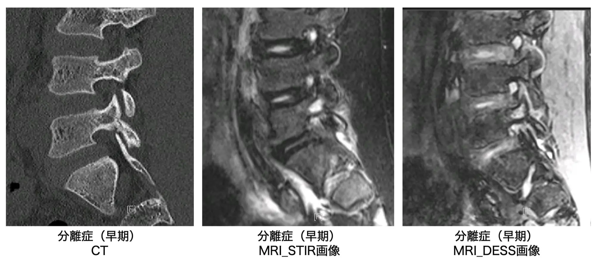 腰椎変性疾患術後の理学療法ガイド【DVD4枚組】ME296-S 腰椎変性疾患術後の理学療法ガイド【DVD4枚組・分売不可】 腰椎
