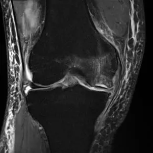 MRI・CT | 【公式】井土ヶ谷整形外科リハビリクリニック